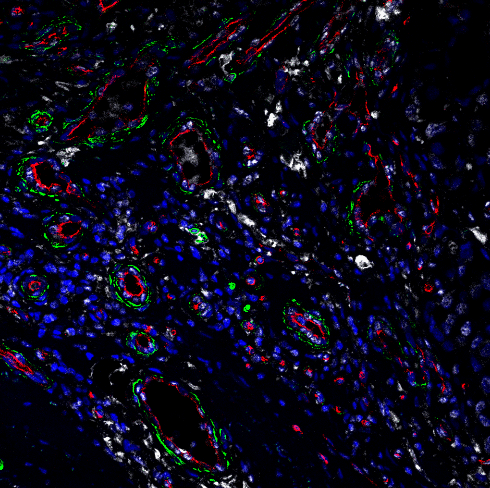 A digital image of fibroblasts